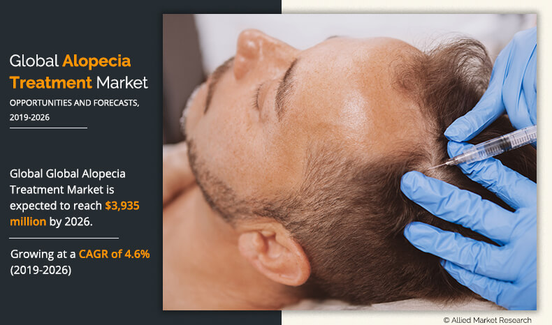 Alopecia Treatment Market infographics
