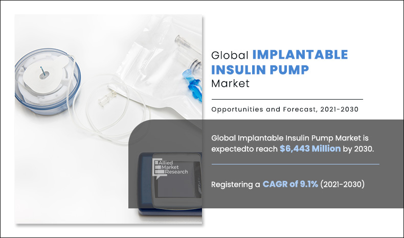 Implantable Insulin Pump Market