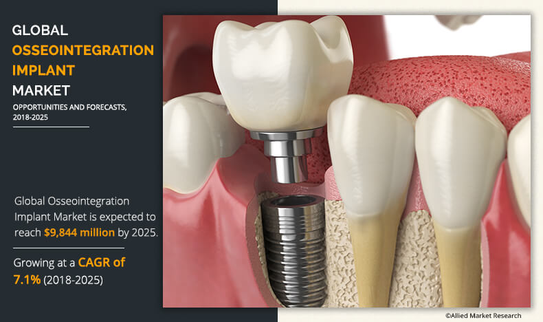 Osseointegration Implants Market