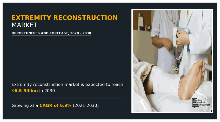 Extremity Reconstruction Market Will Reflect Significant Growth by the End of 2030 |Allied Market Research