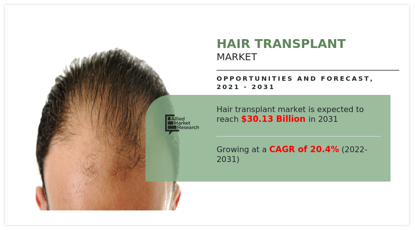 Hair Transplant