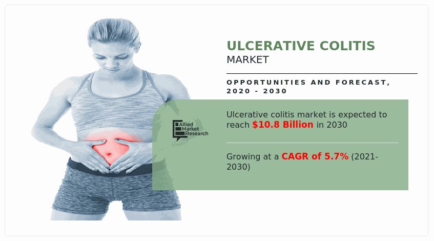 Ulcerative Colitis Market Size In 2023 : High Demand, Share, Top Countries Data, Industry Analysis by Top Players, and Forecasts to 2030