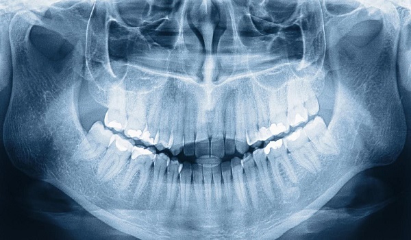 Dental Imaging Market