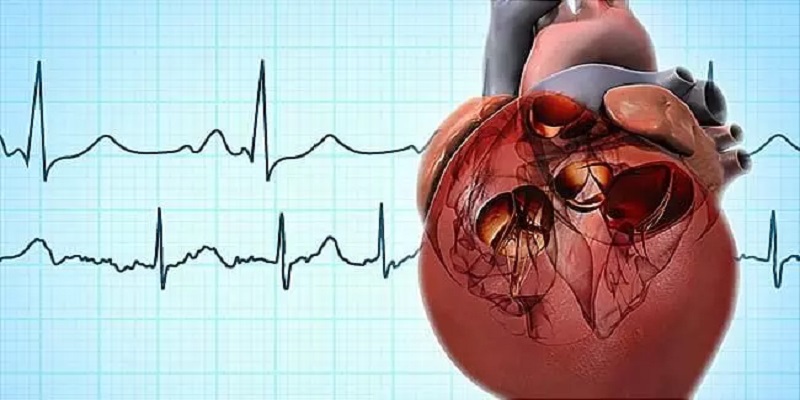 Atrial Fibrillation Surgery Market