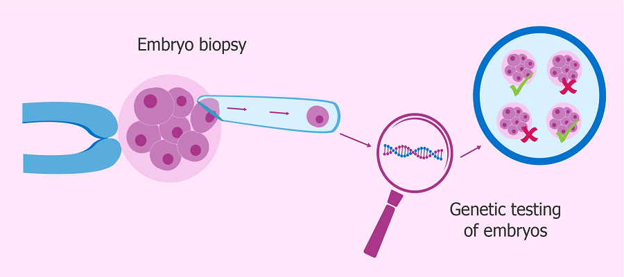 Preimplantation Genetic Testing Market